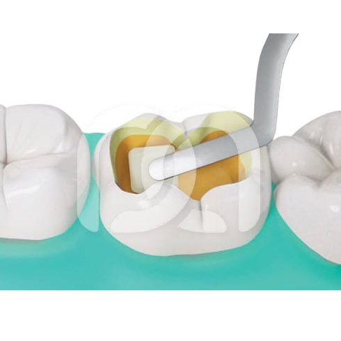 FIBRAFILL CUBE S (9)