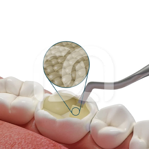 FIBRAFILL CUBE S (9)