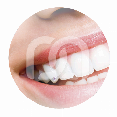 SKYCE CRISTAL TOOTH GEMS DIA 1.9MM  (5)