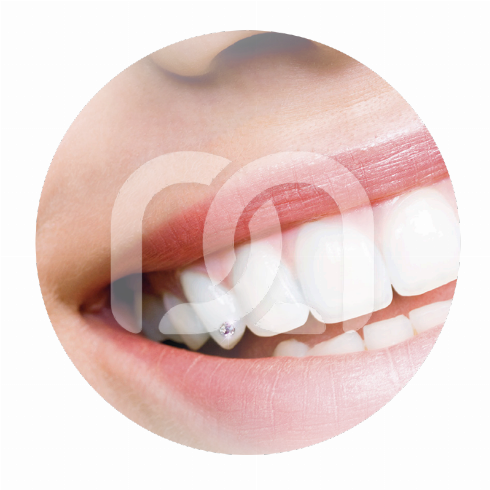 SKYCE CRISTAL DIA 1.9MM (5)