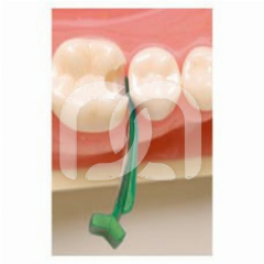 FENDERMATE - LE COFFRET ASSORTI FENDERMATE - LE COFFRET ASSORTI