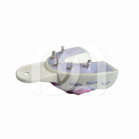 MIRATRAY IMPLANT - INTRODUCTIE KIT 