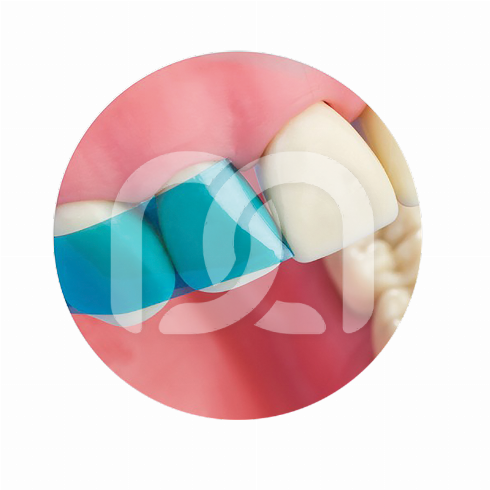 VARISTRIP BLUE VIEW - MATRICES ANTERIEURES (100)