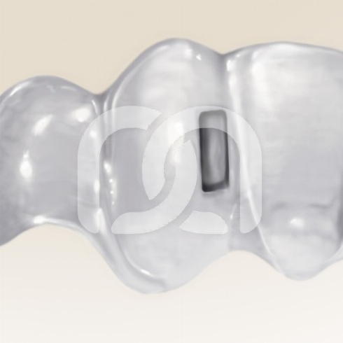 THE VERTICAL HU-FRIEDY TANG