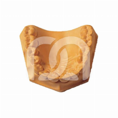Tandheelkundig Gips Silky-Rock Klasse IV (15 kg)