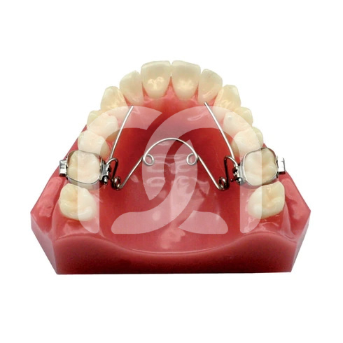 Dispositif d'Expansion Quad-Helix Maxillaire (1)