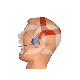 Casque de Traction Orthodontique Large (5) : TAILLE:LARGE, COULEUR PRINCIPALE:ROUGE