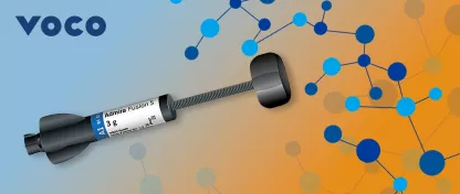 Restauratie van een anterior tand met de innovatieve ORMOCER® technologie