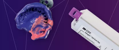 EMPREINTE IMPLANTAIRE AVEC L'IMPREGUM™  SOFT QUICK STEP